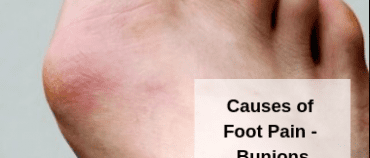 The Causes of Foot Pain – Bunions