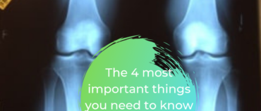 The 4 most important things you need to know about knee OA