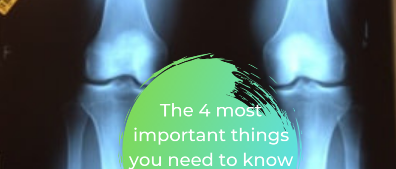 The 4 most important things you need to know about knee OA